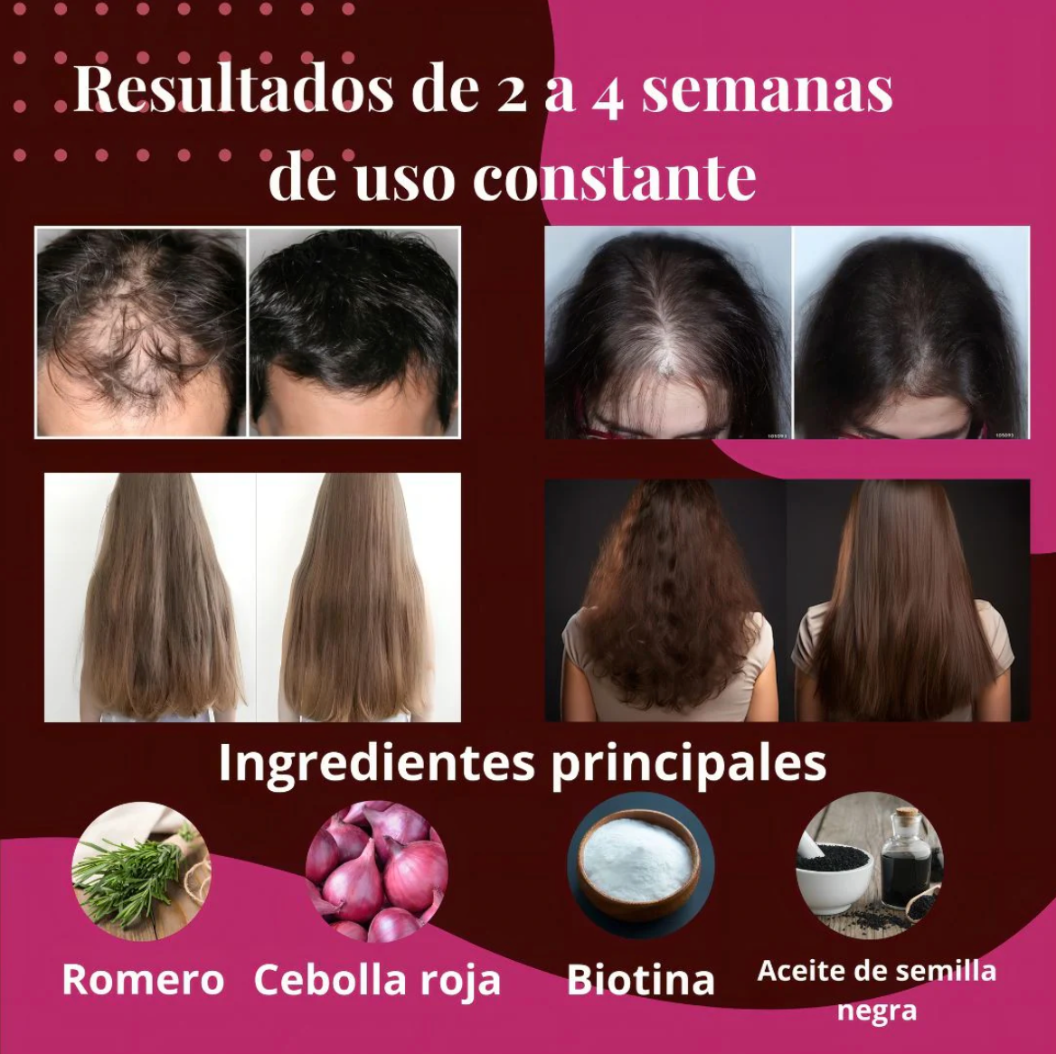 Kit de Cebolla y Biotina