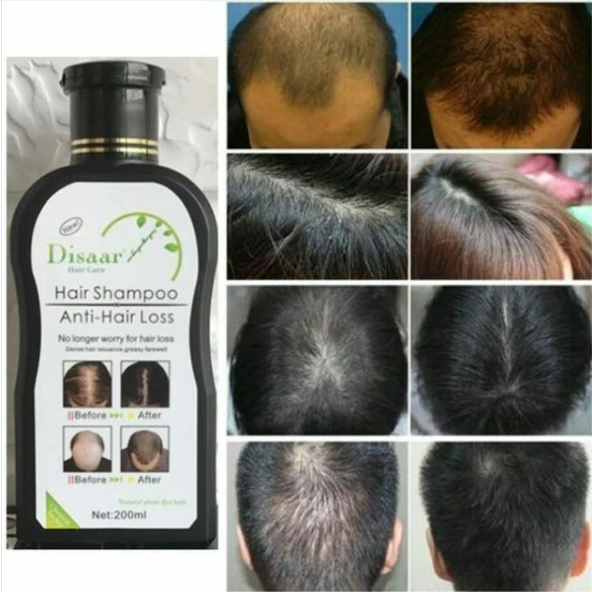 Shampoo profesional capilar