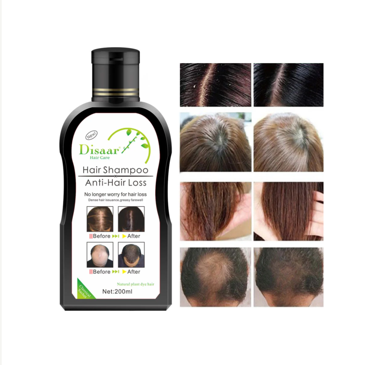 Shampoo profesional capilar