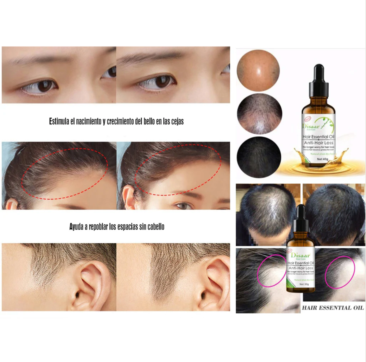 Aceite Profesional Capilar